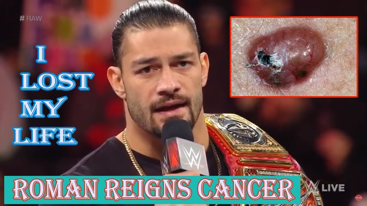 Roumjan R Did Roman Reigns Have Blood Cancer? – ELACI